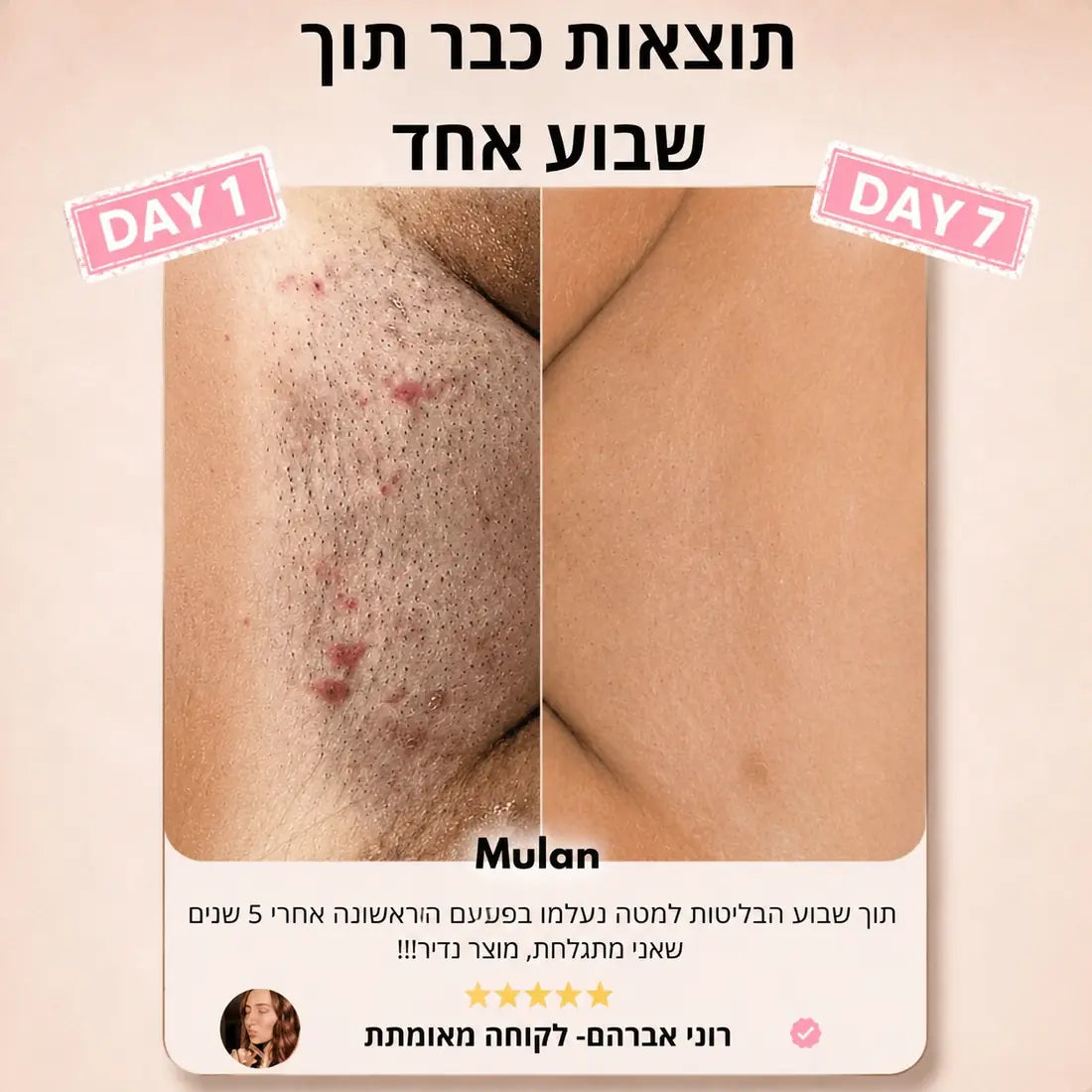 אזור בית השחי ביום 1 וביום 7
